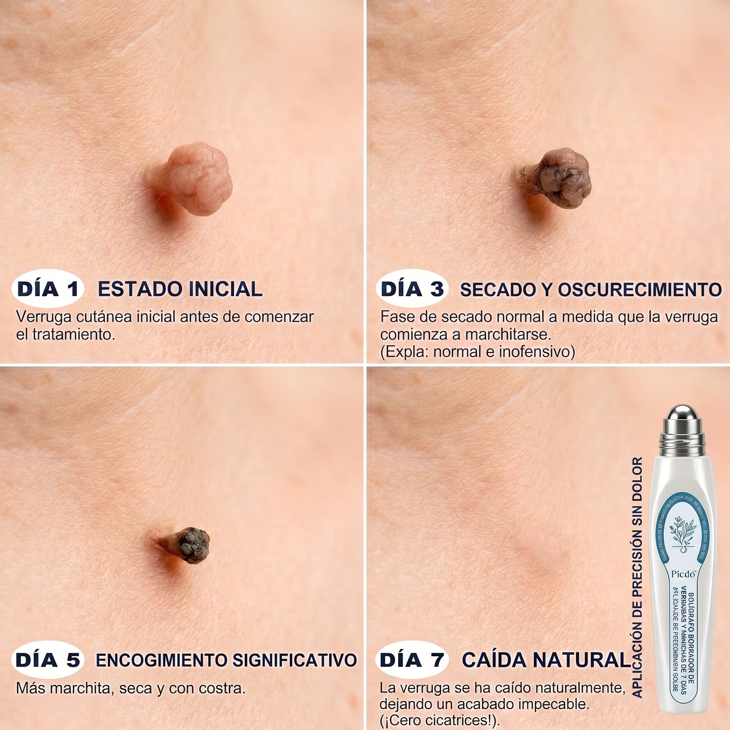 𝐏𝐢𝐜𝐝𝐨® 𝐁𝐨𝐫𝐫𝐚𝐝𝐨𝐫 𝐝𝐞 𝐞𝐭𝐢𝐪𝐮𝐞𝐭𝐚𝐬 𝐲 𝐦𝐚𝐧𝐜𝐡𝐚𝐬 𝐞𝐧 𝟕 𝐝í𝐚𝐬 (𝐀𝐩𝐥𝐢𝐜𝐚𝐝𝐨𝐫 𝐫𝐨𝐥𝐥-𝐨𝐧: 𝐬𝐢𝐧 𝐝𝐨𝐥𝐨𝐫 𝐧𝐢 𝐜𝐢𝐜𝐚𝐭𝐫𝐢𝐜𝐞𝐬)🎉