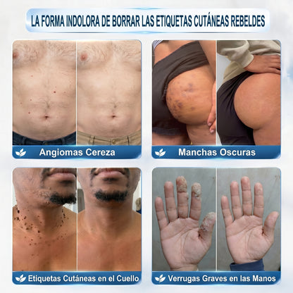 𝐏𝐢𝐜𝐝𝐨® 𝐁𝐨𝐫𝐫𝐚𝐝𝐨𝐫 𝐝𝐞 𝐞𝐭𝐢𝐪𝐮𝐞𝐭𝐚𝐬 𝐲 𝐦𝐚𝐧𝐜𝐡𝐚𝐬 𝐞𝐧 𝟕 𝐝í𝐚𝐬 (𝐀𝐩𝐥𝐢𝐜𝐚𝐝𝐨𝐫 𝐫𝐨𝐥𝐥-𝐨𝐧: 𝐬𝐢𝐧 𝐝𝐨𝐥𝐨𝐫 𝐧𝐢 𝐜𝐢𝐜𝐚𝐭𝐫𝐢𝐜𝐞𝐬)🎉