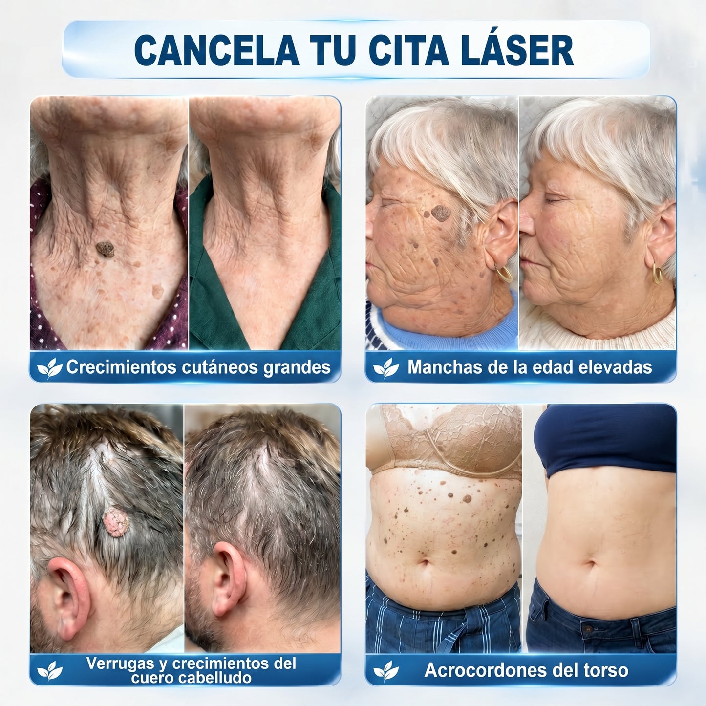 𝐏𝐢𝐜𝐝𝐨® 𝐁𝐨𝐫𝐫𝐚𝐝𝐨𝐫 𝐝𝐞 𝐞𝐭𝐢𝐪𝐮𝐞𝐭𝐚𝐬 𝐲 𝐦𝐚𝐧𝐜𝐡𝐚𝐬 𝐞𝐧 𝟕 𝐝í𝐚𝐬 (𝐀𝐩𝐥𝐢𝐜𝐚𝐝𝐨𝐫 𝐫𝐨𝐥𝐥-𝐨𝐧: 𝐬𝐢𝐧 𝐝𝐨𝐥𝐨𝐫 𝐧𝐢 𝐜𝐢𝐜𝐚𝐭𝐫𝐢𝐜𝐞𝐬)🎉