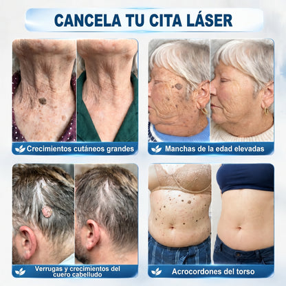 𝐏𝐢𝐜𝐝𝐨® 𝐁𝐨𝐫𝐫𝐚𝐝𝐨𝐫 𝐝𝐞 𝐞𝐭𝐢𝐪𝐮𝐞𝐭𝐚𝐬 𝐲 𝐦𝐚𝐧𝐜𝐡𝐚𝐬 𝐞𝐧 𝟕 𝐝í𝐚𝐬 (𝐀𝐩𝐥𝐢𝐜𝐚𝐝𝐨𝐫 𝐫𝐨𝐥𝐥-𝐨𝐧: 𝐬𝐢𝐧 𝐝𝐨𝐥𝐨𝐫 𝐧𝐢 𝐜𝐢𝐜𝐚𝐭𝐫𝐢𝐜𝐞𝐬)🎉