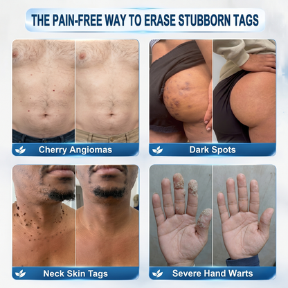 𝐏𝐢𝐜𝐝𝐨® 𝐁𝐨𝐫𝐫𝐚𝐝𝐨𝐫 𝐝𝐞 𝐞𝐭𝐢𝐪𝐮𝐞𝐭𝐚𝐬 𝐲 𝐦𝐚𝐧𝐜𝐡𝐚𝐬 𝐞𝐧 𝟕 𝐝í𝐚𝐬 (𝐀𝐩𝐥𝐢𝐜𝐚𝐝𝐨𝐫 𝐫𝐨𝐥𝐥-𝐨𝐧: 𝐬𝐢𝐧 𝐝𝐨𝐥𝐨𝐫 𝐧𝐢 𝐜𝐢𝐜𝐚𝐭𝐫𝐢𝐜𝐞𝐬)