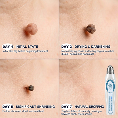 𝐏𝐢𝐜𝐝𝐨® 𝐁𝐨𝐫𝐫𝐚𝐝𝐨𝐫 𝐝𝐞 𝐞𝐭𝐢𝐪𝐮𝐞𝐭𝐚𝐬 𝐲 𝐦𝐚𝐧𝐜𝐡𝐚𝐬 𝐞𝐧 𝟕 𝐝í𝐚𝐬 (𝐀𝐩𝐥𝐢𝐜𝐚𝐝𝐨𝐫 𝐫𝐨𝐥𝐥-𝐨𝐧: 𝐬𝐢𝐧 𝐝𝐨𝐥𝐨𝐫 𝐧𝐢 𝐜𝐢𝐜𝐚𝐭𝐫𝐢𝐜𝐞𝐬)